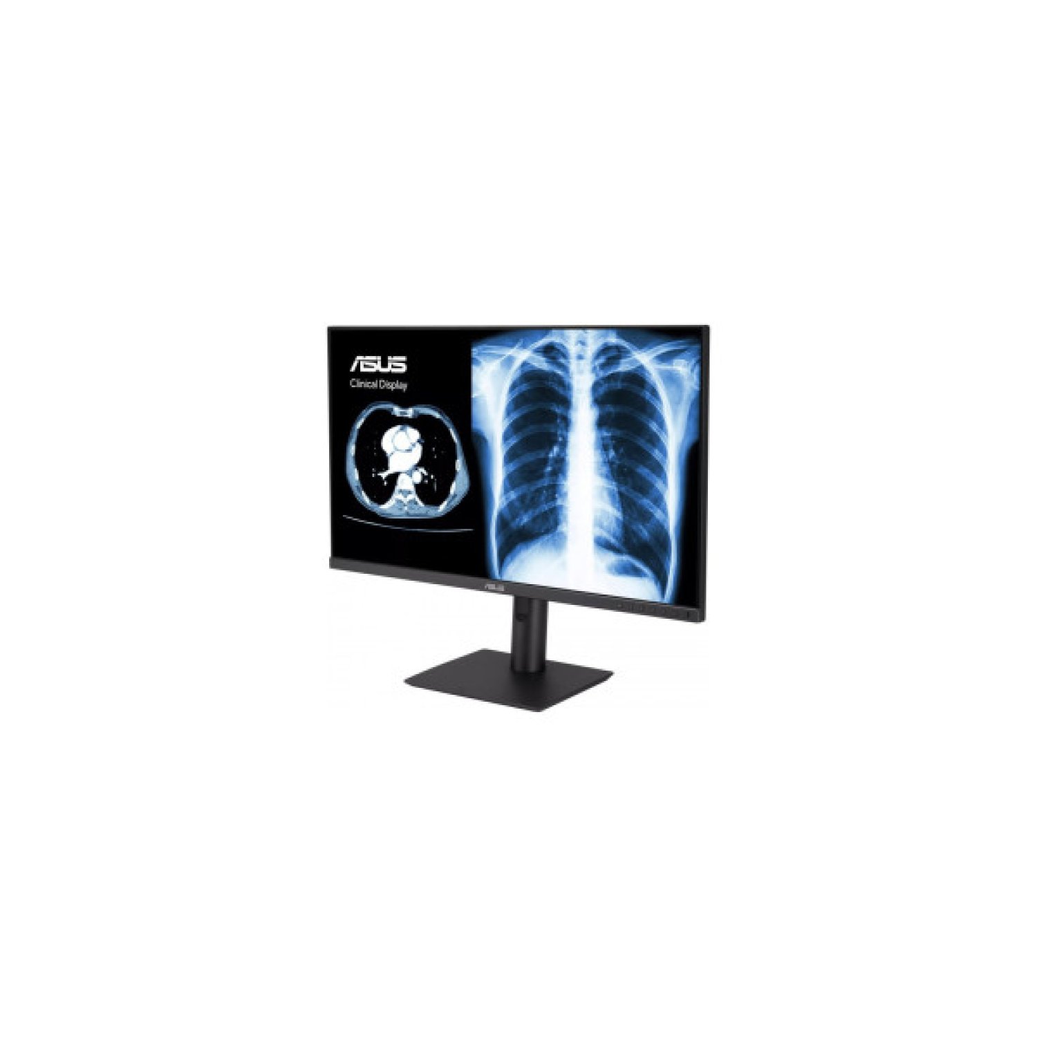 ASUS Monitor Clínico MH2441A · 24" · 2560x1440 · 3.6MP · DICOM · Calibración Automática